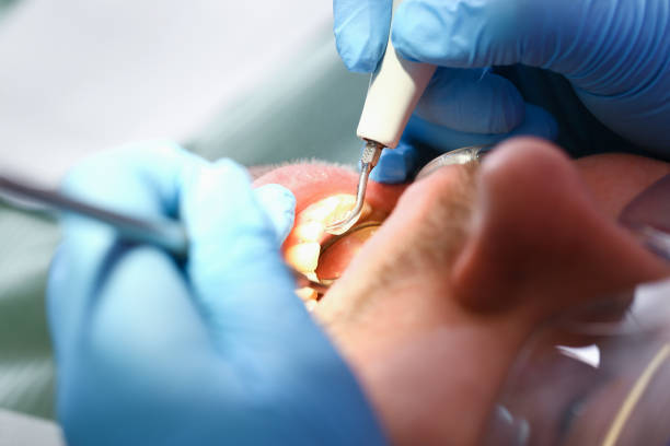 Best Mobile Emergency Dentist in Little River Academy, TX