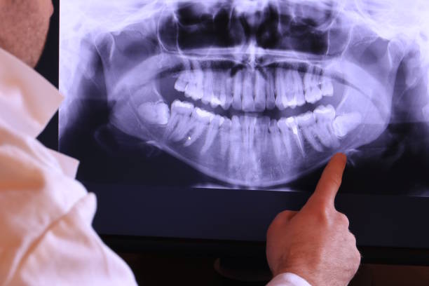 Best Emergency Root Canal Treatment in Little River Academy, TX