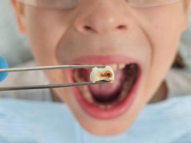 Best Weekend Emergency Dentist in Little River Academy, TX